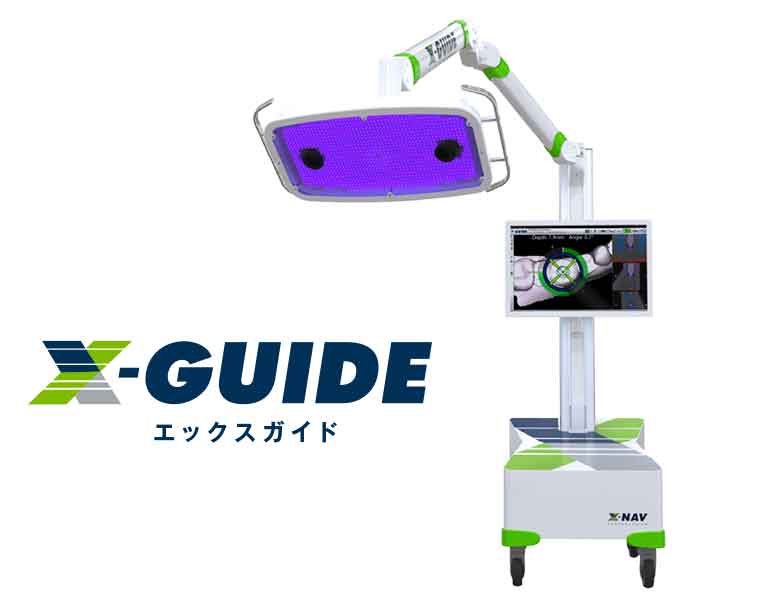X-Guide エックスガイド