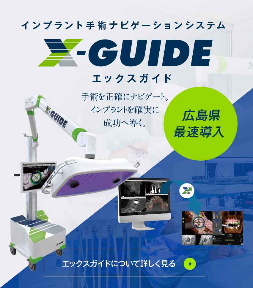 広島県最速導入 X-Guide インプラント手術ナビゲーションシステム