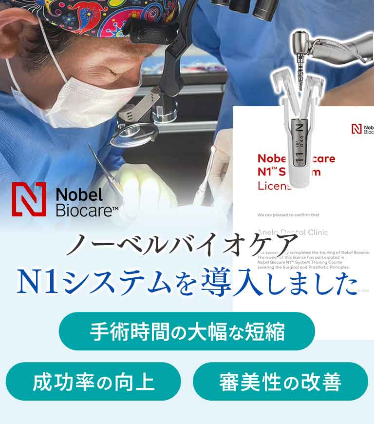 平均相場よりリーズナブルな価格でオールオンフォー治療をご提供しております